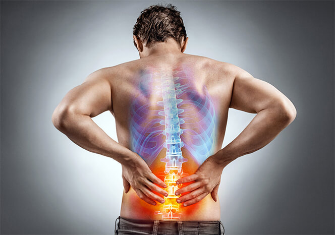 Lumbar Spinal Stenosis: Symptoms, Causes, & Treatments | CalSpineMD